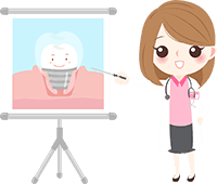 dental implants santa barbara illustration